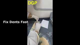 ฟิลเลอร์ร่างกาย